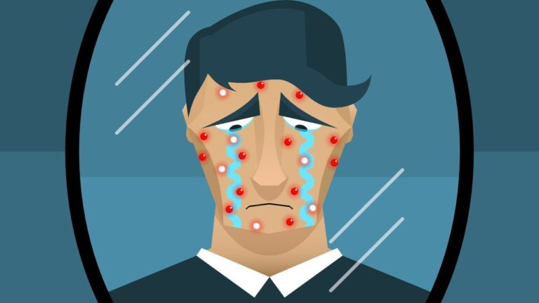 Wpływ chorób skóry na psychikę